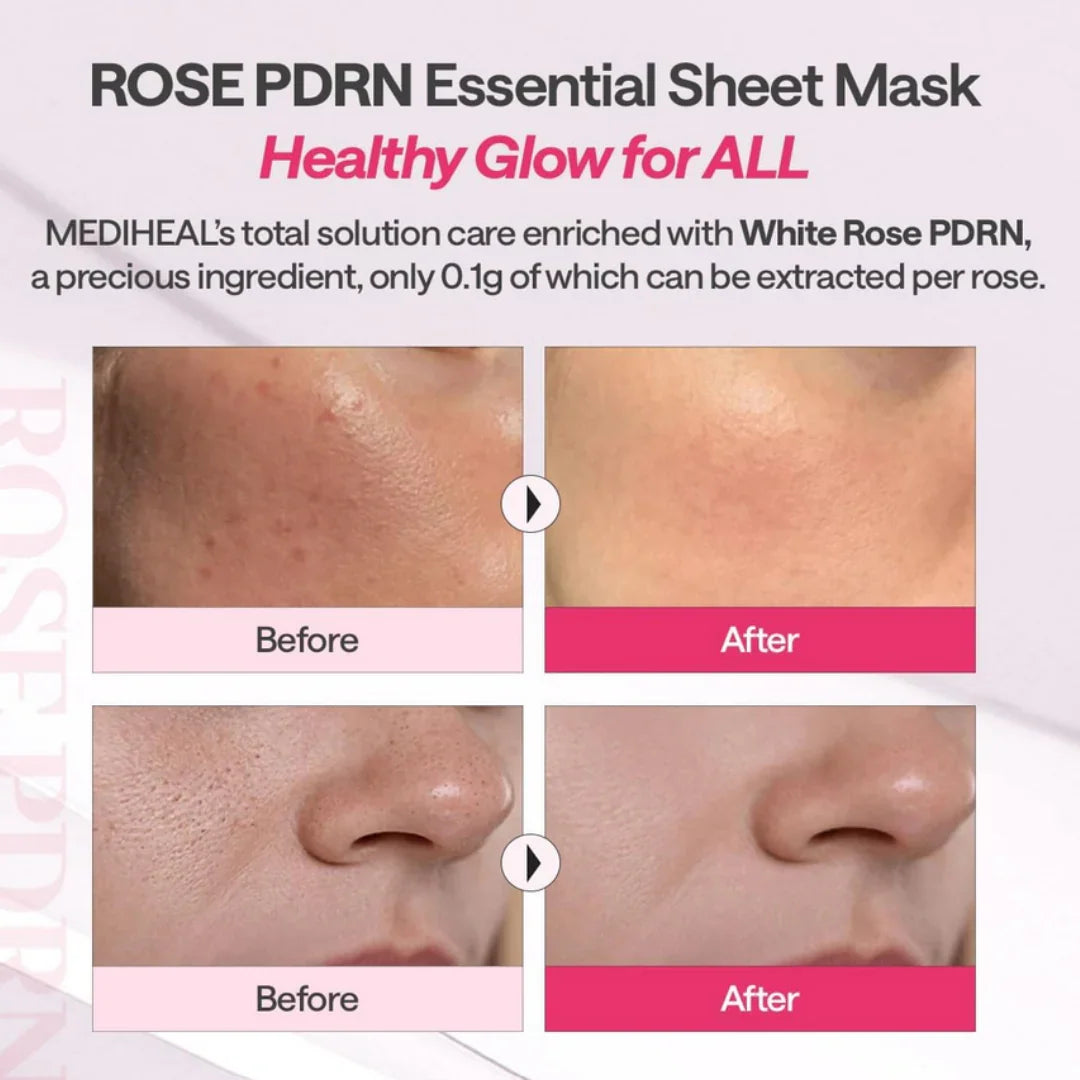 MedihealMEDIHEAL British White Rose PDRN Essential Mask Sheet Bio Emulsome 1 PcMood Arabia